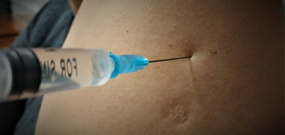 Kviečia registruotis skiepijimui nuo COVID-19