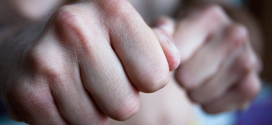 Užpuolė nepažįstami jaunuoliai