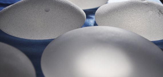 Specialistai atsako: kaip tinkamai pasiruošti krūtų didinimui?