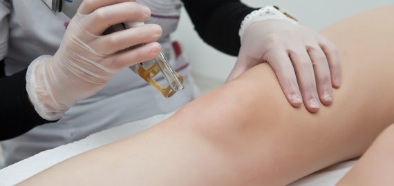 Pasiruošimas lazerinei depiliacijai ir tinkamas elgesys po procedūrų