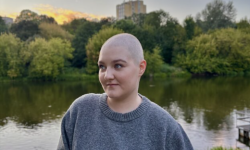 Vėžio užklupta 25-erių Miglė apie ligą kalba kitaip: „Nepameskite savęs diagnozėje“
