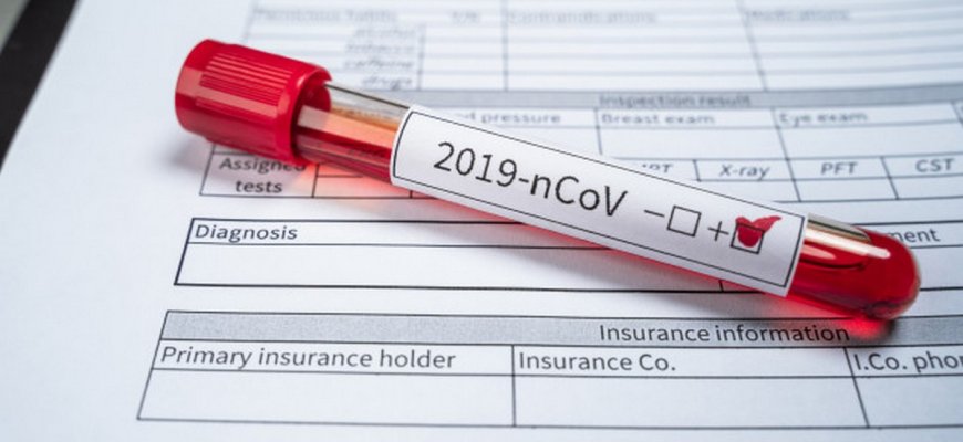 Koronavirusu užsikrėtusiųjų padaugėjo iki 203