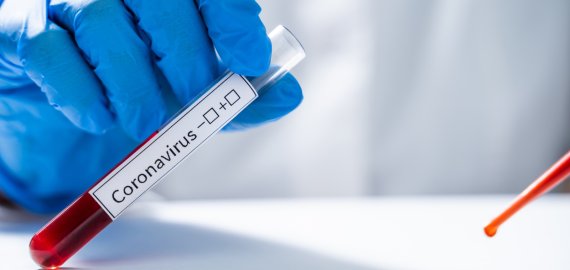 Per parą Lietuvoje patvirtinti septyni nauji koronaviruso atvejai