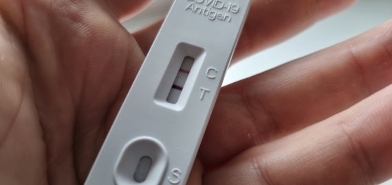Į profesinių ligų sąrašą įtrauktas COVID-19 virusas