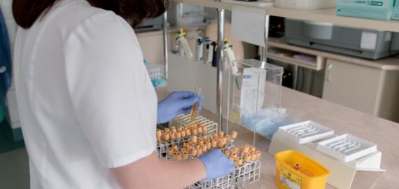 Lietuvoje nustatyti dar 24 koronaviruso atvejai, bendras skaičius – 129 