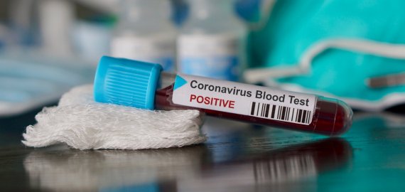 Per parą patvirtinti 23 nauji koronaviruso atvejai