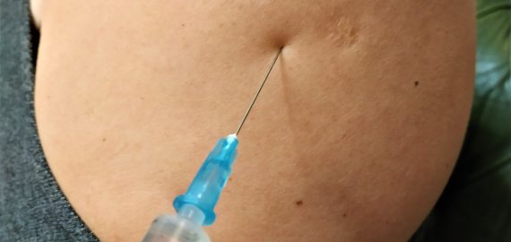 SAM atnaujino COVID-19 vakcinacijos planą, masinis skiepijimas numatytas pavasarį