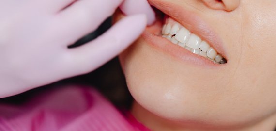 Danties protezavimas vyresniame amžiuje – ar yra amžiaus ribos?