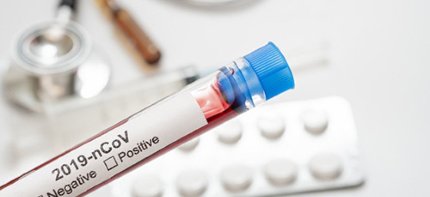 Per parą nustatyti 142 nauji koronaviruso atvejai, vienas žmogus mirė