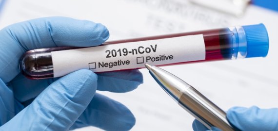 Praėjusią parą patvirtinta 15 naujų koronaviruso atvejų, bendras skaičius – 1947